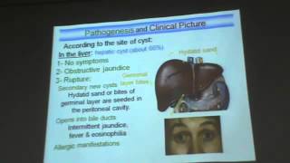 Dr Azza Parasitology Echinococcus granulosus amp hydatidosis YouTube [upl. by Leaper54]