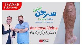 Teaser  Varicose Veins پاؤں میں خون کی نالی کا پھولنا  Ep 6  ft Haseeb Khan amp Dr Wajahat Amir [upl. by Netsyrc]