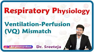 Ventilationperfusion VQ mismatch  Respiratory physiology USMLE Step 1 [upl. by Middendorf]