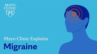 Mayo Clinic Explains Migraine [upl. by Ellehcirt]