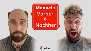 Manuels Transformation  Lordhair Haarsystem für Männer [upl. by Mayes]