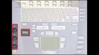 Primer on knobology for the MTurbo SonoSite system [upl. by Guy]