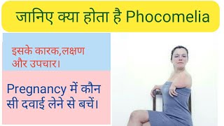 What is Phocomelia its cause and treatment [upl. by Cia]