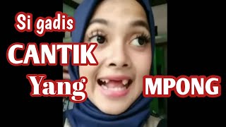 kintanmary Aksi kocak kintan mary si Gadis cantik yang ompong [upl. by Robinia174]