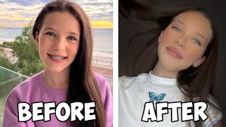 Her Biggest TRANSFORMATION She Got Her Braces Off The Empire Family [upl. by Lorrimer]