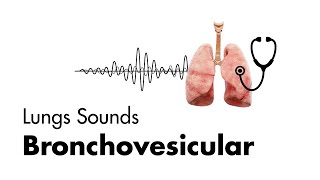 Bronchovesicular Breath Sounds  Lung Sounds  MEDZCOOL [upl. by Garling]