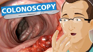 Colonoscopy [upl. by Adym141]