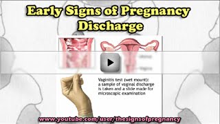 Early Signs of Pregnancy Discharge [upl. by Galvin]