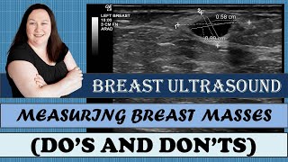 Breast Ultrasound  Measuring Breast Masses Dos amp Donts  Registry Review Series [upl. by Eloccin]