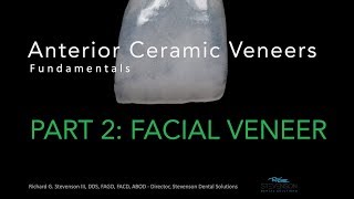 Anterior Ceramic Veneers Part 2 Facial Veneer [upl. by Nicholl]