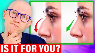 Nose Job Explained by a Surgeon [upl. by Lola762]