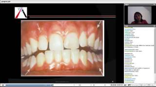 Periodontics  Gingiva and Tooth Supporting Structure [upl. by Yak]