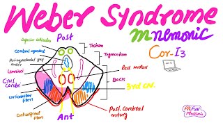 Weber SyndromeMnemonic for USMLEPlabFCPS medicine [upl. by Kendrah]