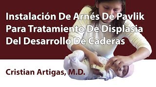 Instalación De Arnés De Pavlik Para Tratamiento De Displasia Del Desarrollo De Caderas [upl. by Randa]