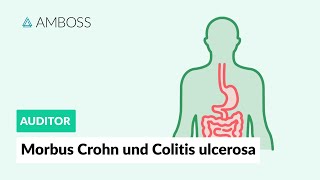 Morbus Crohn und Colitis ulcerosa  Worin unterscheiden sie sich  AMBOSS Auditor [upl. by Enymzaj]