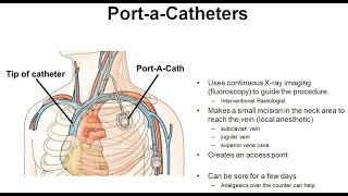 24 Principles of Port A Cath Placement amp Management [upl. by Hpeosj]