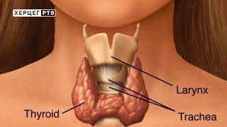 Štitna žlijezda Otkrijte sami prve znakove bolesti 21042018 [upl. by Matias]
