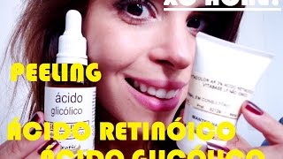 PELE SEM ACNE E OLEOSIDADE COM O PEELING DE ACIDO RETINÓICO E ACIDO GLICÓLICO [upl. by Notlek579]