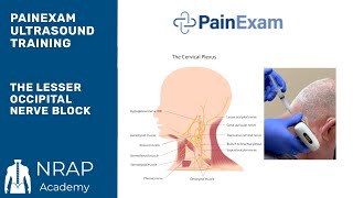 The Ultrasound Guided Lesser Occipital Nerve Block NRAP Academys Ultrasound Course excerpt [upl. by Marve]