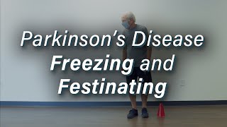 Parkinsons Disease Freezing amp Festinating Gait [upl. by Izy]