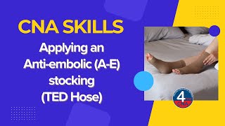 CNA Skills Applying Ted Hose with testing checkpoints [upl. by Leizo]