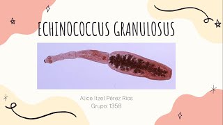 Echinococcus Granulosus Hidatidosis Unilocular [upl. by Nairrod]