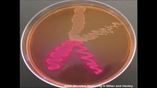 Micro Lab 6 Selective and Differential Media [upl. by Cordell]