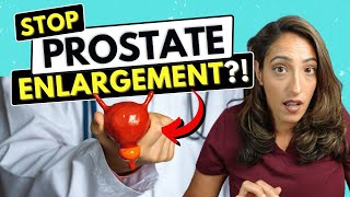 Best Ways to Prevent Prostate Enlargement Explained by a Urologist [upl. by Muhan]