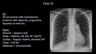 How to Interpret a Chest XRay Lesson 10  Self Assessment Part 2 [upl. by Eilis]