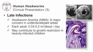 Helminths Hookworms [upl. by Lehsreh]