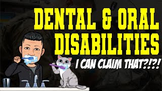 Get To 100 VA Disability Rating With Dental amp Oral Disabilities [upl. by Yeffej]