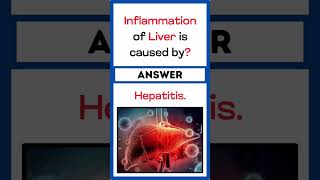 liverinflammation causes hepatitis biology study education quiz temple generalknowledgequiz [upl. by Chauncey309]