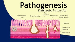 Pathogenesis of Entamoeba histolytica  parasitology  Basic Science Series [upl. by Gebler]