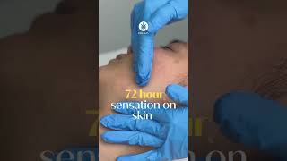 New Spicule Peel  GWANG PEEL 72 hours sensation on skin acnetreatment koreanskincare [upl. by Cara622]