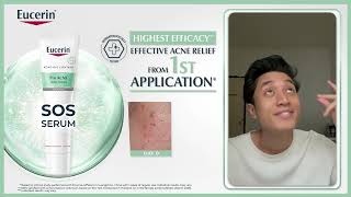 Your Acne Solution  Pro ACNE Solution SOS Serum [upl. by Atyekram402]