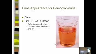 UA Lecture 6 Blood Bilirubin and Urobilinogen [upl. by Fatima697]