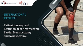 INTERNATIONAL PATIENT  Patient Journey amp Testimonial  Arthroscopic Meniscectomy and Synovectomy [upl. by Ailecec]