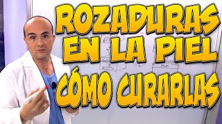 ROZADURAS EN LA PIEL y CÓMO CURARLAS  Enfermedades 42 [upl. by Nekial]