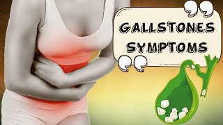 Gallstones  Signs amp Symptoms [upl. by Ayatnahs]