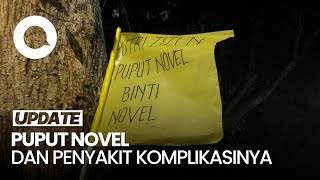 Puput Novel Berpulang Seusai 3 Tahun Berjuang Lawan Kanker Payudara [upl. by Raclima]