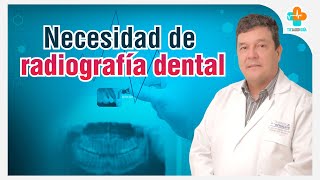 Necesidad de Radiografía Dental  Tu Salud Guía [upl. by Cirenoj69]