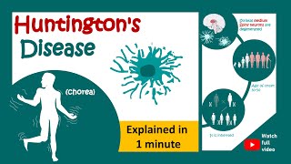 Huntingtons disease in 1 minute  1 minute pathology  Huntingtons chorea [upl. by Napra]