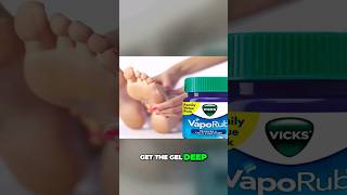 Say Goodbye to Fungal Infections with this Powerful Remedy VICKS VAPORUB [upl. by Noryt]