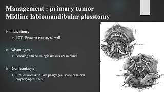 Oropharyngeal Malignancy [upl. by Adelind]