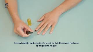 How To Exit Damaged Nails [upl. by Ecnerrat983]