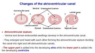 Development congenital heart Interatrial septum Interventricular septum Bulbus cordis Sinus venosus [upl. by Aehsrop]