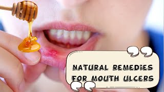 How To Relieve Mouth Ulcers Naturally And Effectively Natural Remedies For Mouth UlcersCanker Sore [upl. by Eldwin]