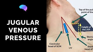 Measuring Jugular Venous Pressure JVP  OSCE Guide Clip  UKMLA  CPSA [upl. by Ecydnarb]