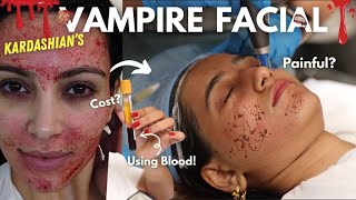 I tried the Vampire Facial 😱 Wait for the RESULTS  Aashi Adani [upl. by Short]