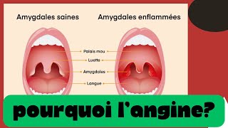 Pourquoi tu as l’angine  Douleur à la gorge et le traitement [upl. by Hurlow89]